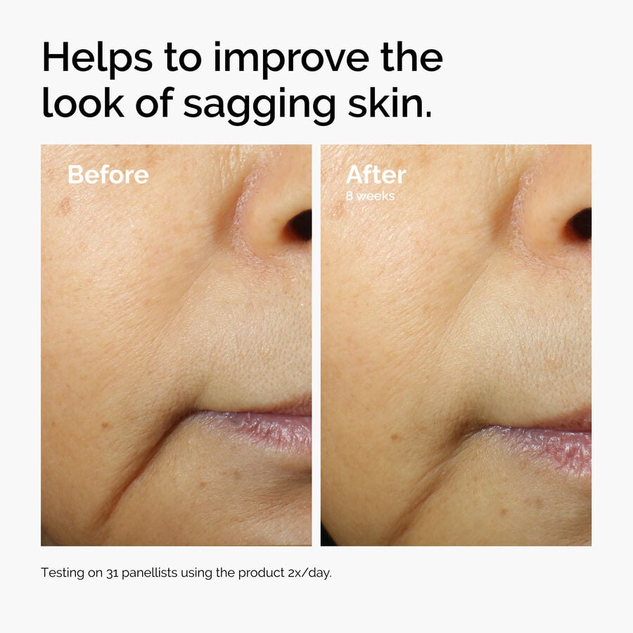 caffeine-3-escin-1-face-serum-x3 ord-caffeine-3pct-escin-1pct-face-serum-before-after-sagging.jpg