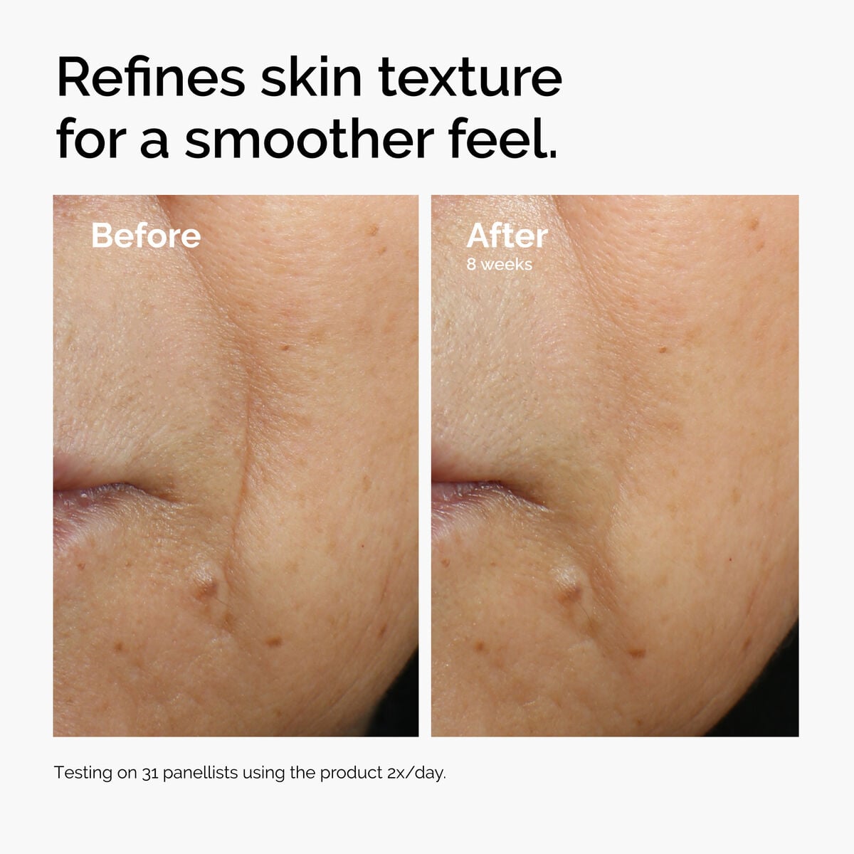caffeine-3-escin-1-face-serum-x3 ord-caffeine-3pct-escin-1pct-face-serum-before-after-texture.jpg