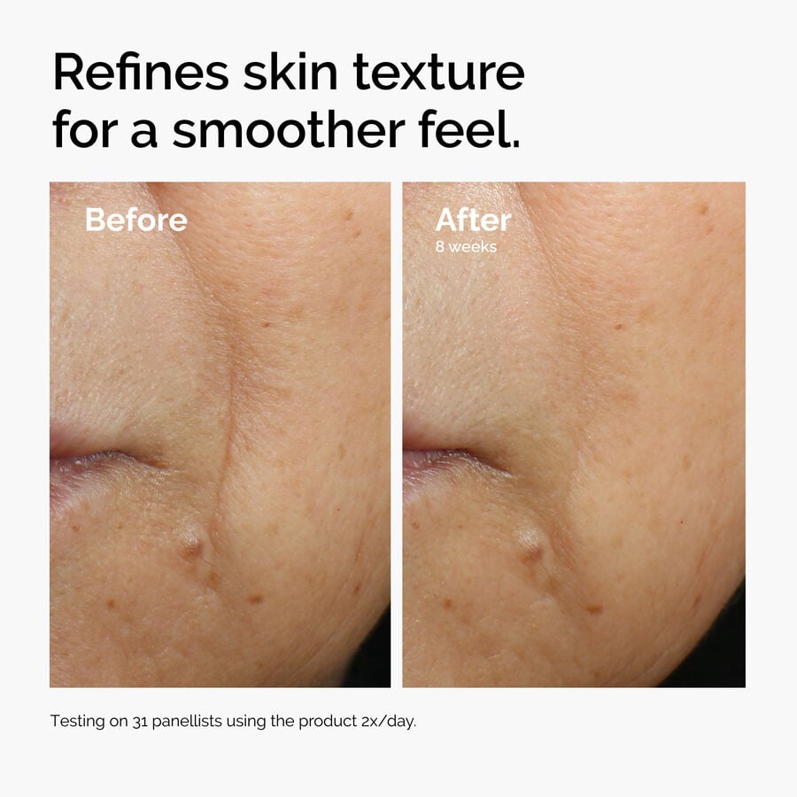 caffeine-3-escin-1-face-serum-x3 ord-caffeine-3pct-escin-1pct-face-serum-before-after-texture.jpg