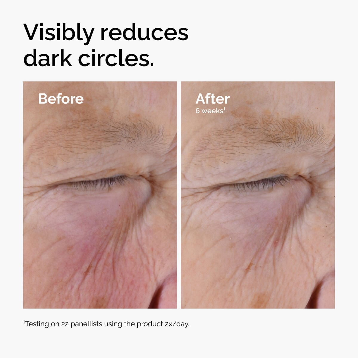 caffeine-solution-5-egcg-eye-serum-i9 ord-caffeine-solution-egcg-dark-circles-before-after.jpg