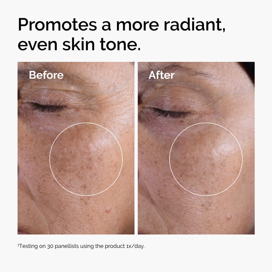 glycolic-acid-7-exfoliating-toner-w2 ord-glycolic-before-after-radiance.jpg
