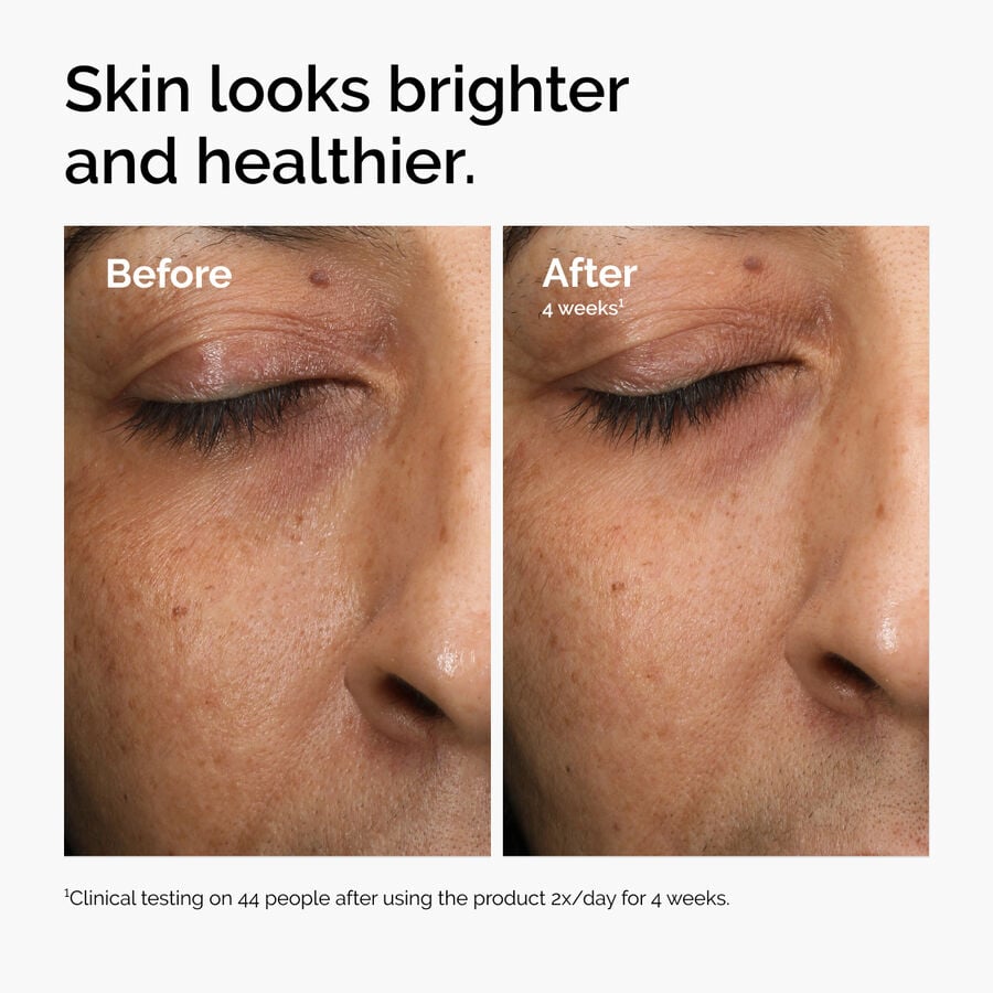 multi-antioxidant-radiance-serum-t2 ord-mars-before-after-healthy.jpg