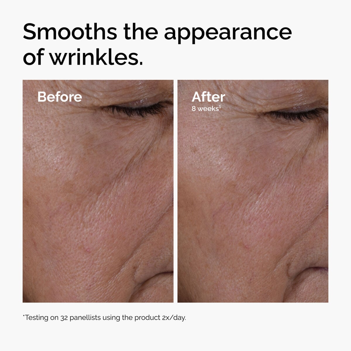 multi-peptide-ha-serum-o8 ord-multi-peptide-ha-serum-wrinkles-before-after.jpg