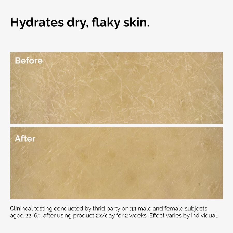 the-body-care-collection-h8 ord-natural-moisturizing-factors-inulin-body-before-after-graphic-02.jpg