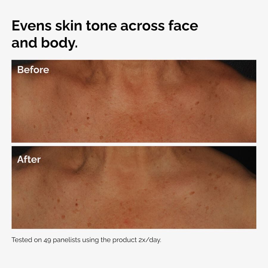 the-body-care-collection-h8 ord-niacinamide-face-body-serum-before-after-even-tone-graphic.jpg