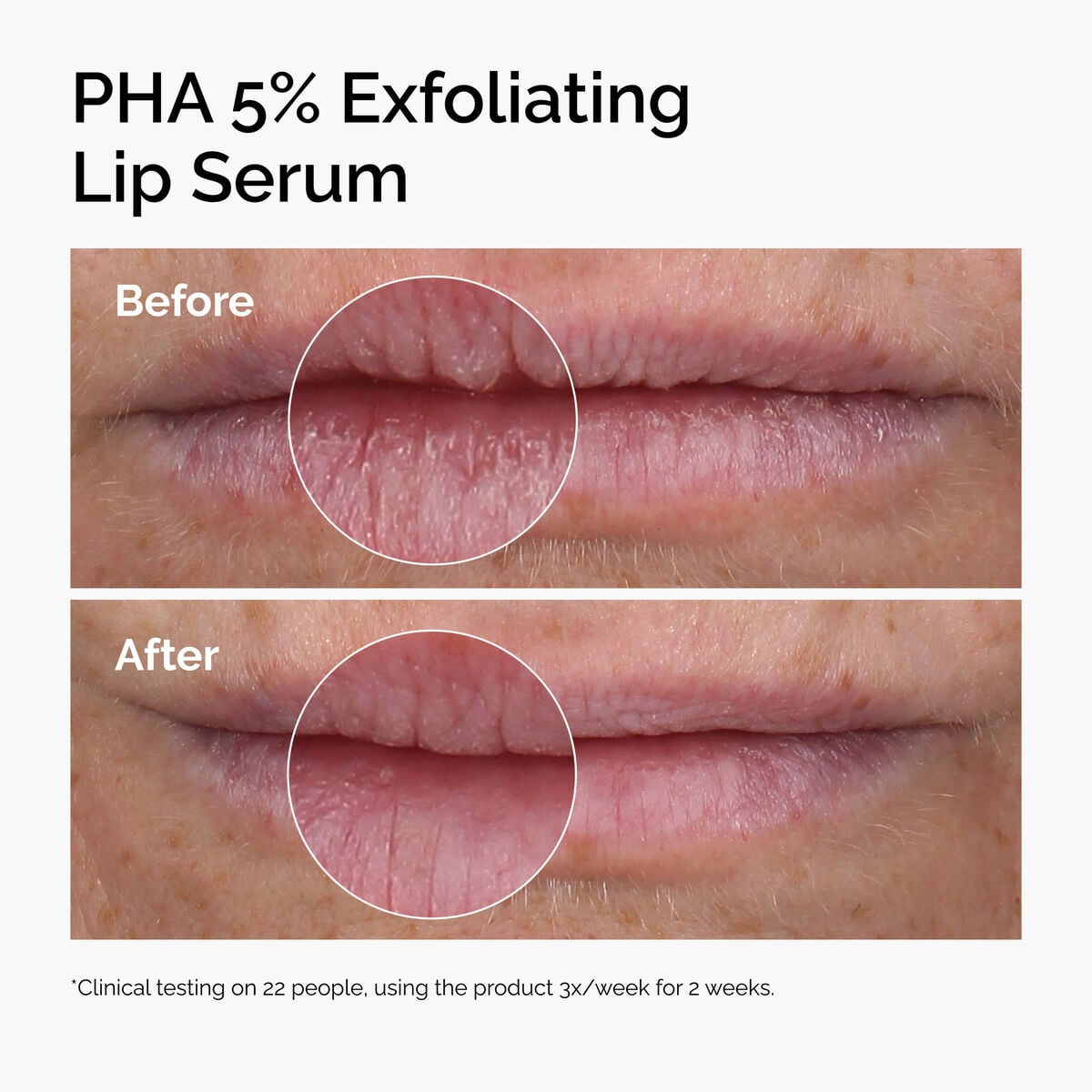 pha-5-exfoliating-lip-serum-m4 ord-pha-5pct-lip-exfoliating-serum-before-after.jpg