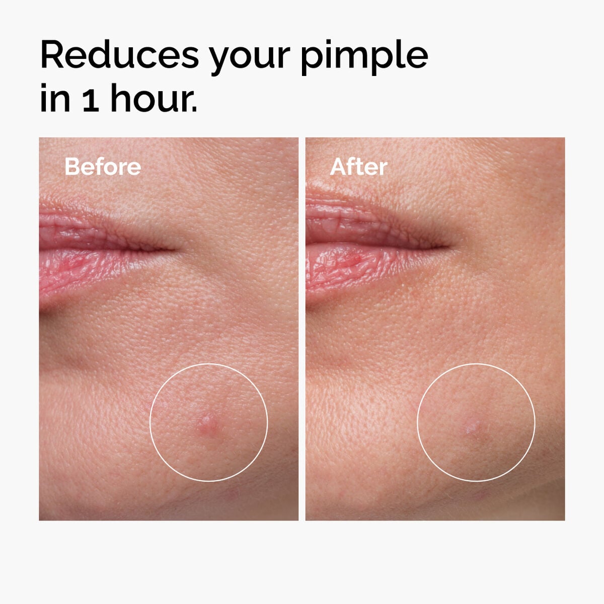 sulfur-10-powder-to-cream-concentrate-l3 ord-sulfur-10pct-powder-to-cream-concentrate-before-after-NA.jpg