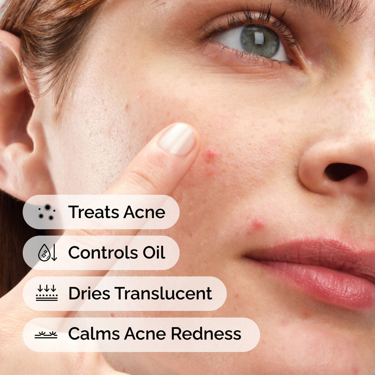 sulfur-10-powder-to-cream-concentrate-l3 ord-sulfur-10pct-powder-to-cream-concentrate-model-application-with-benefits-acne.jpg